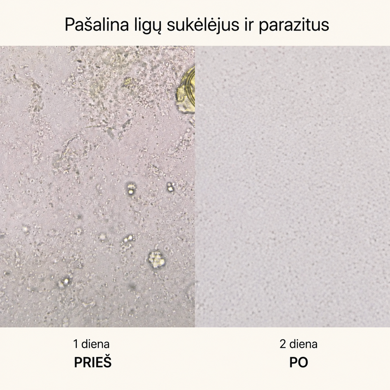 Storosios žarnos veiklai palaikyti