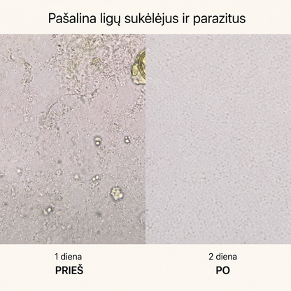 Storosios žarnos veiklai palaikyti
